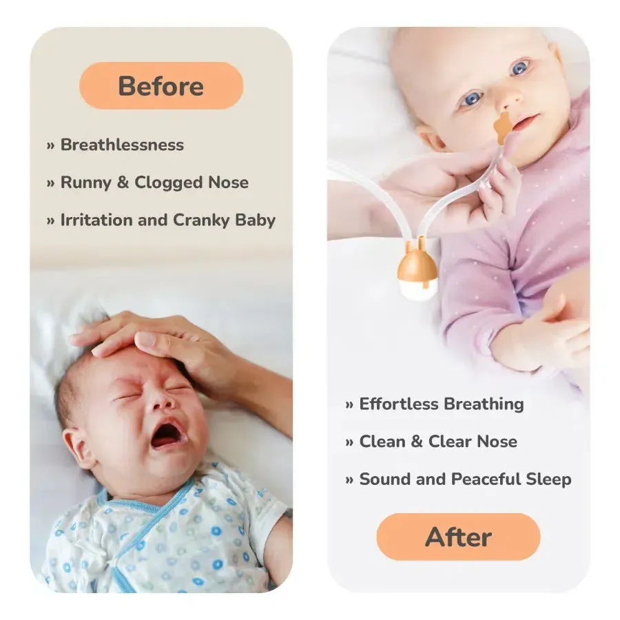 Snowy Nasal Cleaner For Baby Painless Relief from Mucus and Blocked Nose - Image 13