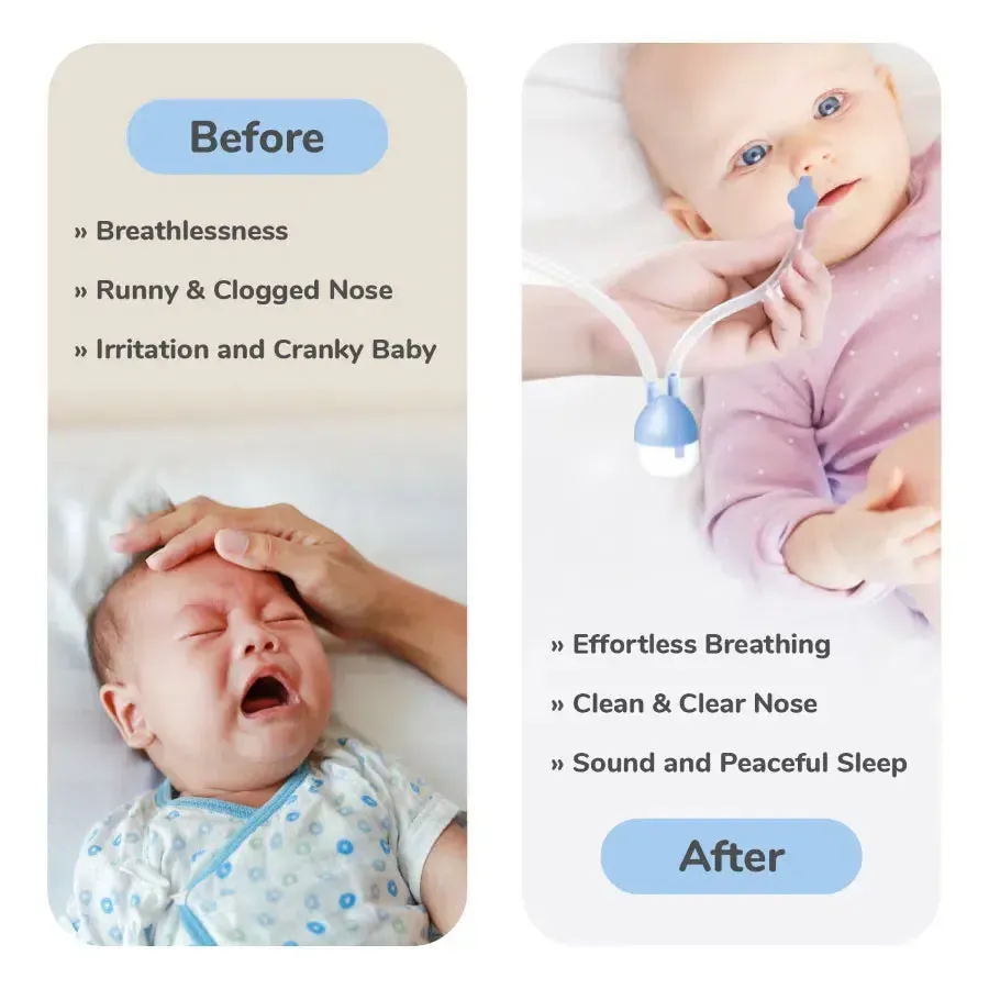 Snowy Nasal Cleaner For Baby Painless Relief from Mucus and Blocked Nose - Image 6